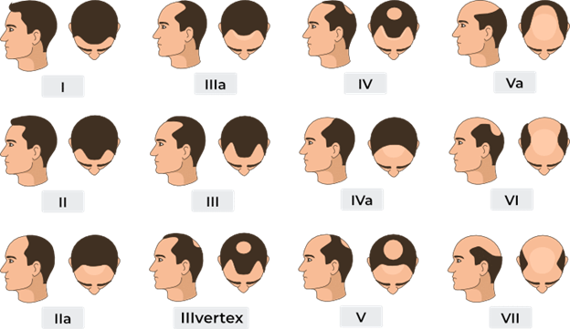 Рисунок1.png Рисунок1.png